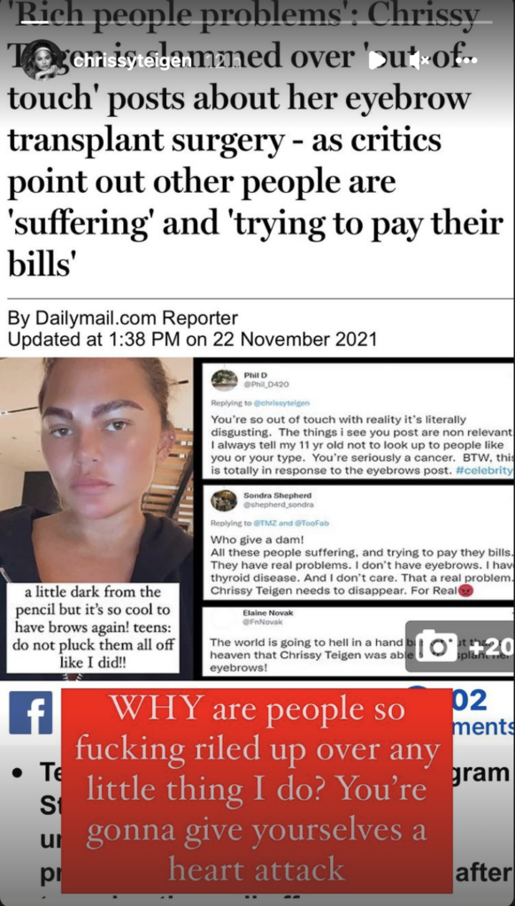 Chrissy Teigen Shaded Over Eyebrow Transplant, Angrily Responds: ‘WHY Are People So F—ing Riled Up Over Any Little Thing I Do’ Chrissy Teigen