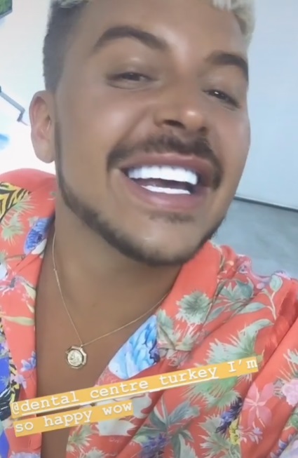 It’s Viral: Big Brother UK Alum Shares “Fox Eyes Thread” Nightmare Aftermath on TikTok