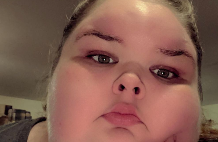 Update: Is Tammy Slaton Ready For Weight Loss Surgery?