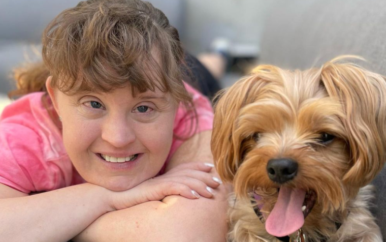 Actress Jamie Brewer Proud To Be A Pioneer For Actors With Down Syndrome