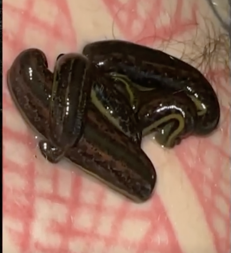 Fans React To Machine Gun Kelly Sharing Video Of Leeches Sucking His Blood