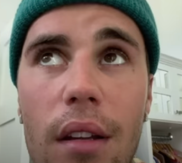 Justin Bieber Feeling Upbeat As He Recovers From Ramsay Hunt Syndrome