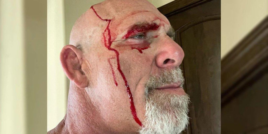 WWE Legend Goldberg Comments After Tractor Accident: “It’s Just A Flesh Wound” WWE Legend Goldberg Comments After Tractor Accident: “It’s Just A Flesh Wound”